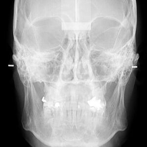 snimanje zuba, 3d snimanje zuba, snimanje zuba beograd, ortopan, ortopan beograd, c dental centar