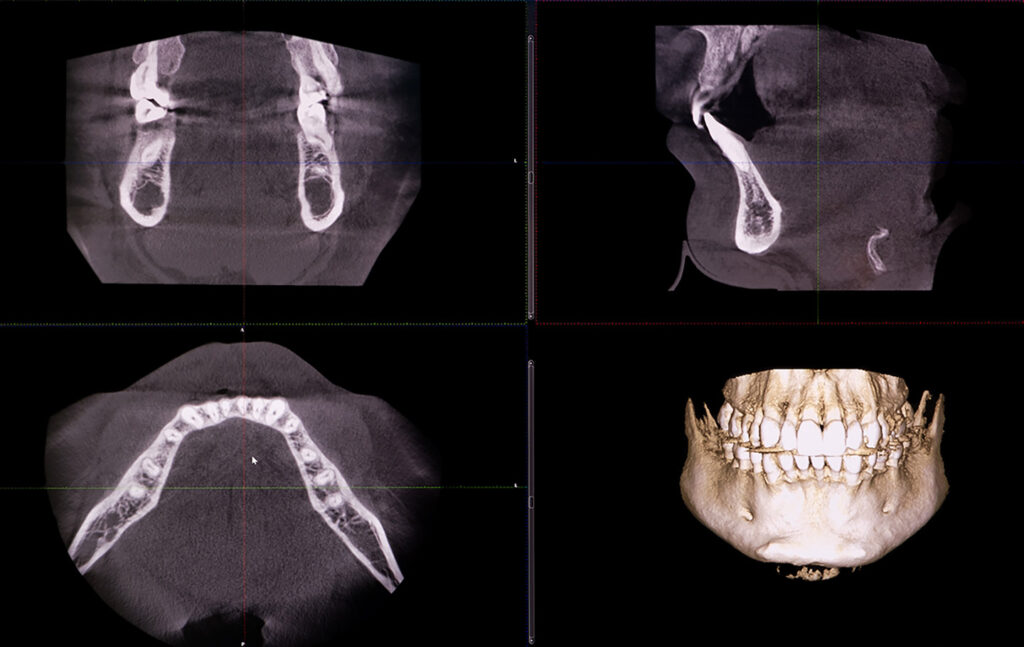 snimanje zuba, 3d snimanje zuba, snimanje zuba beograd, ortopan, ortopan beograd, c dental centar